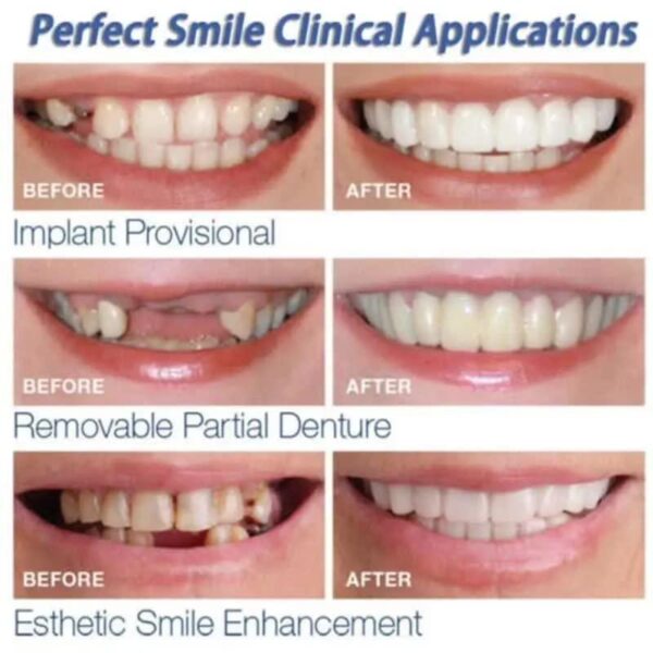 Snap-On Smile Fake Teeth - Image 4