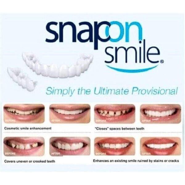 Snap-On Smile Fake Teeth - Image 3