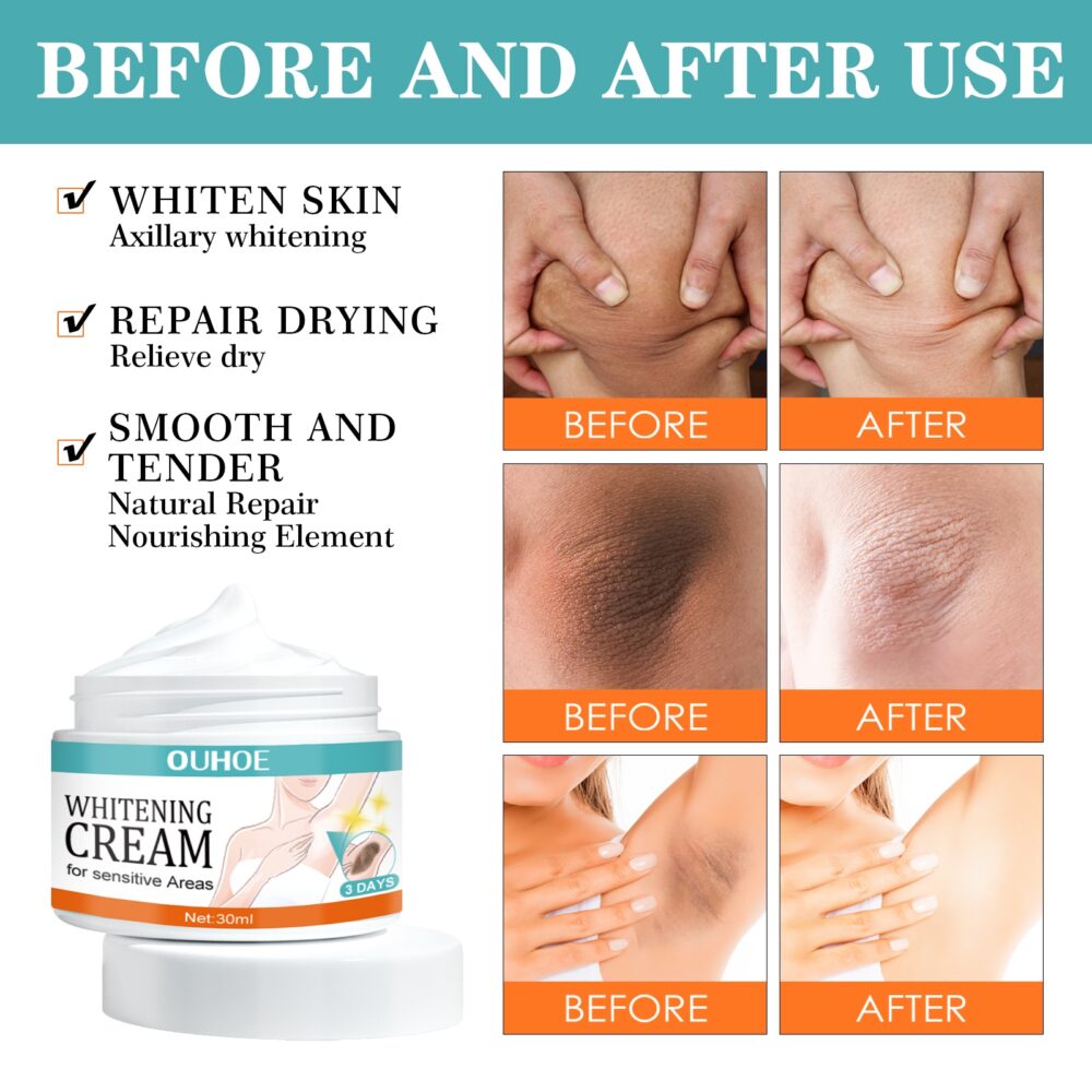 Ouhoe Whitening Cream for Sensitive Areas - Image 5